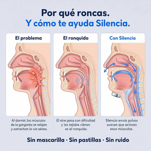 Por qué roncas y cómo te ayuda Silencia